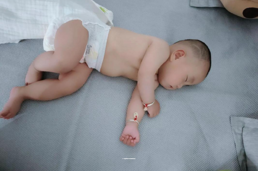 如皋宝宝头上长痱子
